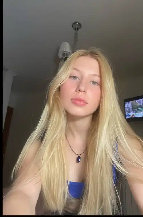 I went outside today, just 5 minutes, this is the result