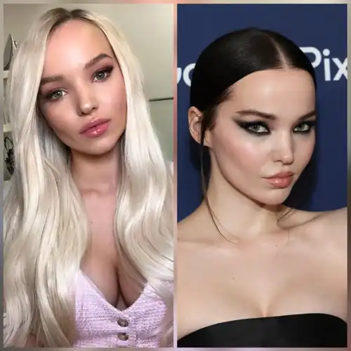 Blonde or dark haired Dove?