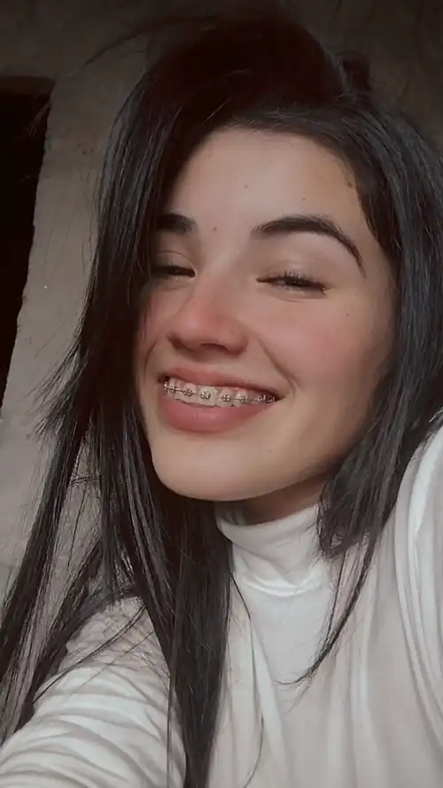 face and braces