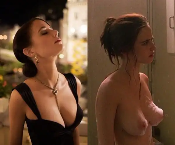 Comparison