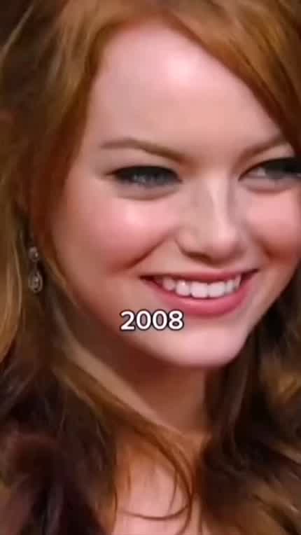 Emma Stone throughout her Career ✨💕😍💋 