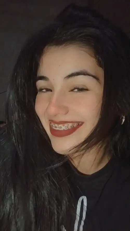 Braces smile