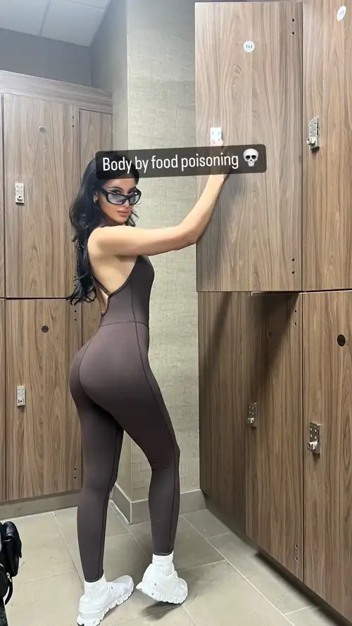Ig story