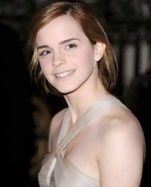 What a smile