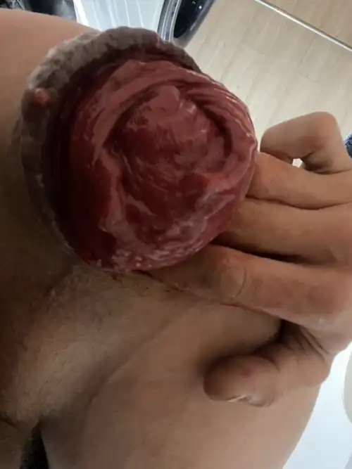 A big prolapse Just for you