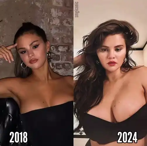 selena 2018 vs 2024