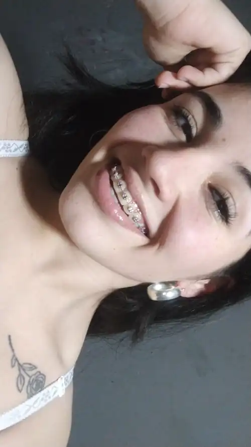 I am very happy with my braces