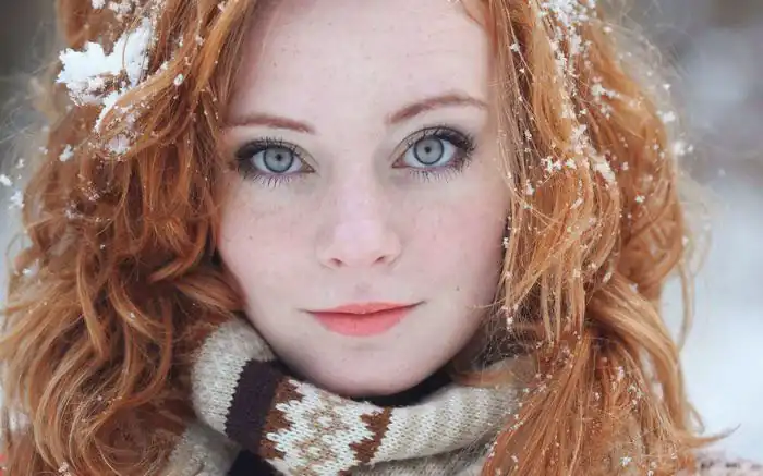 Freckles In The Snow