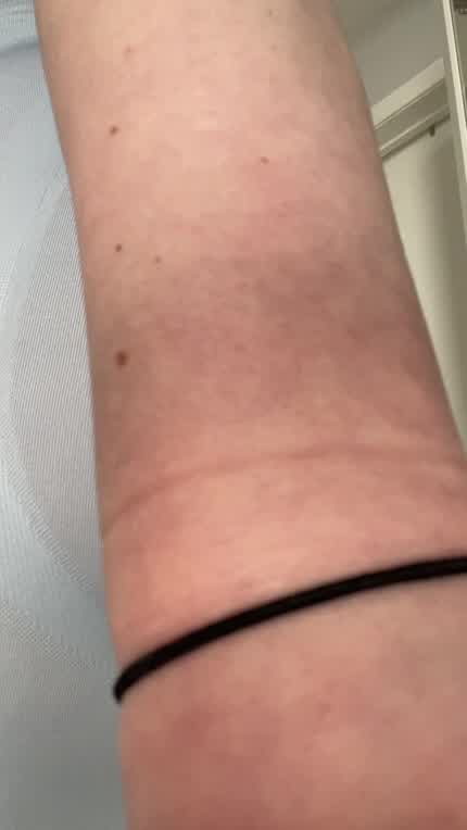 My fat ass ripped my favourite leggings 