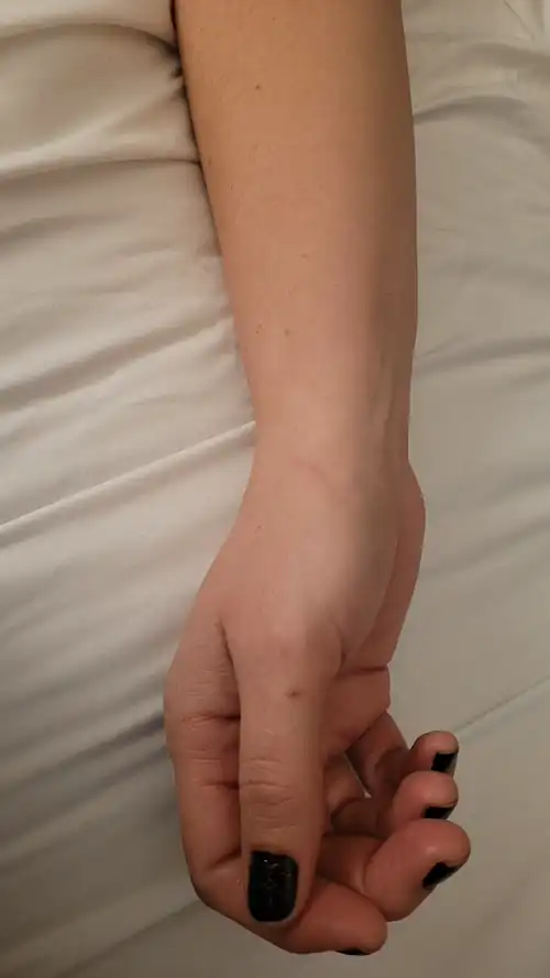 Don't Mind the Scratch