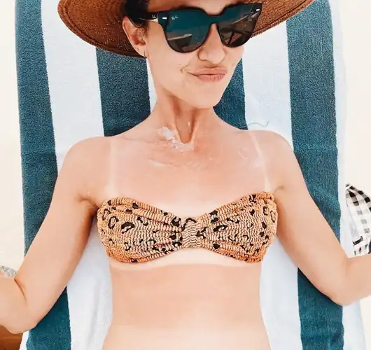 Sunburnt tan lines