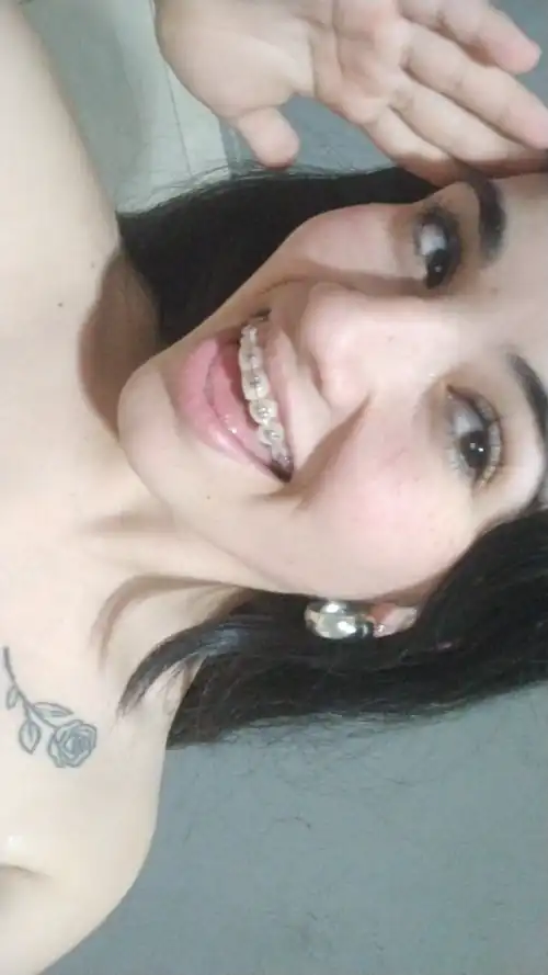 check my braces 